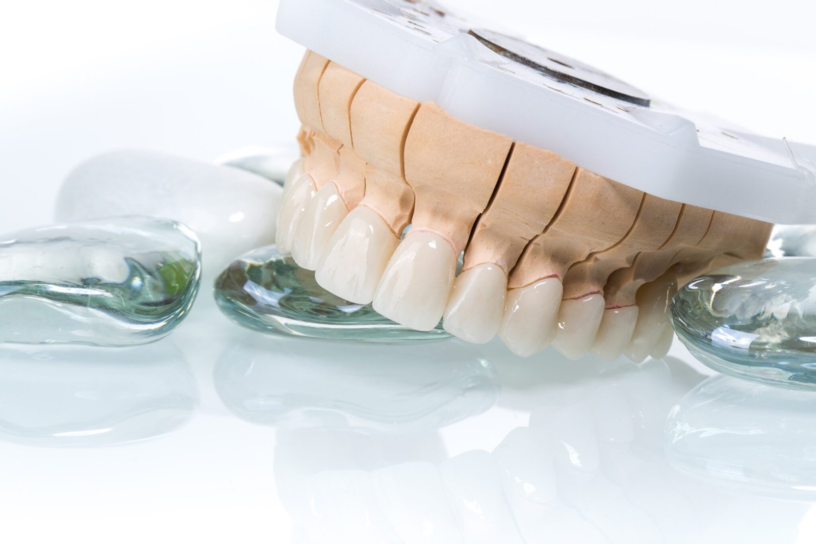 zirconia crown dental